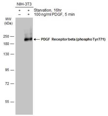 Western Blot: PDGF R beta [p Tyr771] Antibody [NBP3-13239]